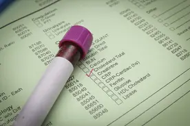 一张化验单就能看出来女性交过几个男朋友吗？看完涨知识图片