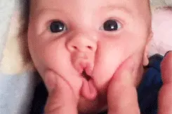 一到换季，宝宝皮肤粗糙干裂？不注意这3点，受罪又毁皮肤图片