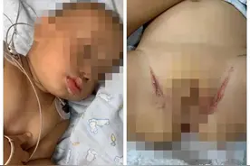 洪水过后，新乡一家庭未用完的消毒剂被1岁孩子误喝图片