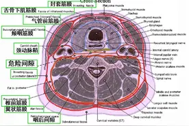 颈部和喉的断层解剖图（含：CT图、详细注解）图片