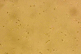 原创视频！揭秘试管婴儿培育全过程！他们真是试管里长大的小宝宝吗？图片