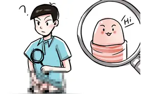 男性朋友主动割包皮，是良好的“自我修养”？随意割完却后悔？图片