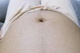 怀孕后，肚子长毛还有黑色直线，怎么回事儿？图片