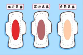 生过宝宝后，恶露怎么办？做到这3点，告别产后恶露图片