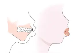 如何知道自己有没有凸嘴？「科普小知识」图片