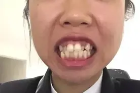 原来，整牙是真的堪比换脸图片