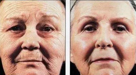 药学博士：“抗初老”成分那么多，究竟哪些才能有效紧致肌肤？