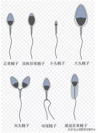 辅助生殖技术中精液是怎么优化的?