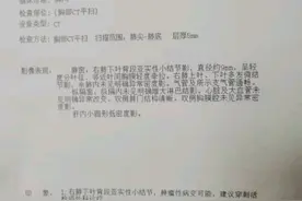 刘懿博士说肺癌（二九一五）肺结节只有CT报告能过来住院吗？图片