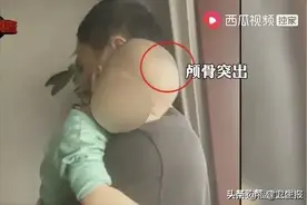 痛心！湖南再现多名“大头娃娃”，只因喝了这款“假奶粉”！家长该如何避免掉坑？图片