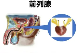 关注前列腺疾病，让男人不再有难言之隐图片