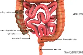 临时造口多久能拆掉？肠癌患者的永久造口VS临时造口有什么区别？图片