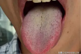 一剂金铃子散，两味药清肝火、行气止痛，横扫肝炎、胃炎、胆囊炎图片