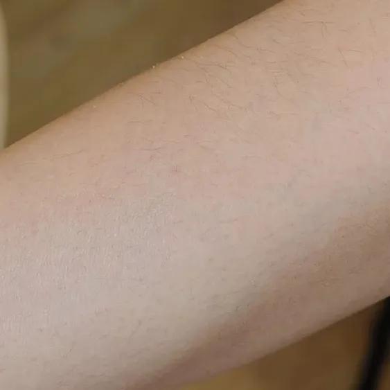 野脚鸡皮肤穿裙子 野脚鸡皮肤穿裙子