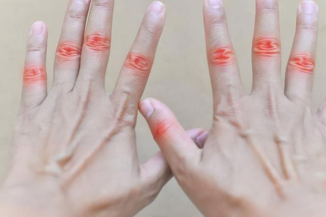 手指头痛是怎么回事,手指疼痛,原因多是这4个,若病情反复,及早对因