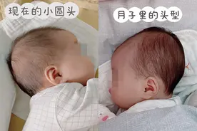 孩子“头圆脑门大”，是聪明的象征？头型不仅关乎颜值更影响智力图片