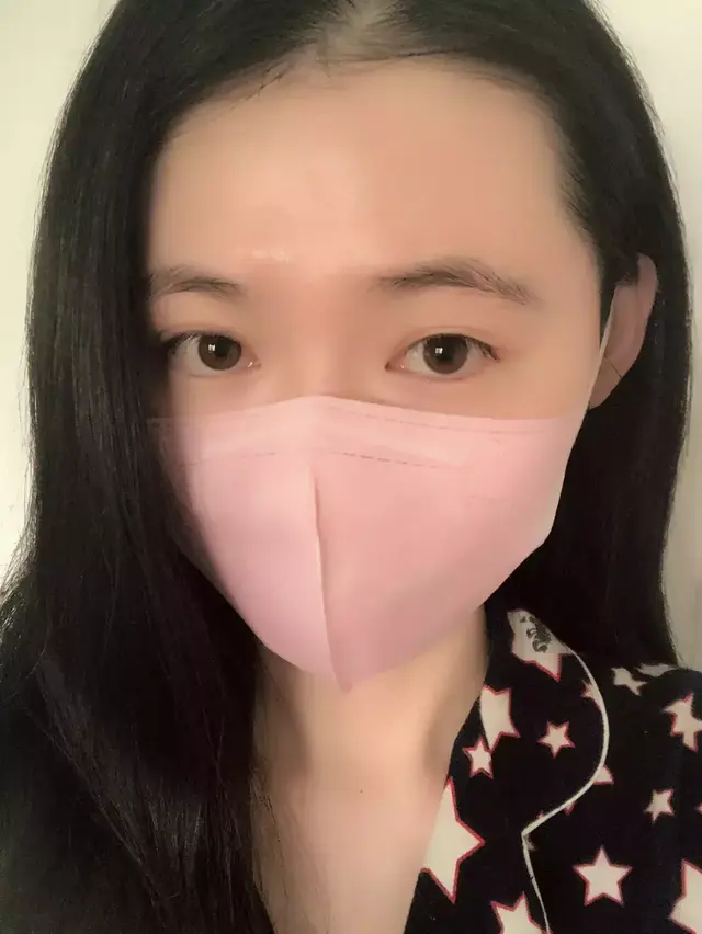 身上起鸡皮疙瘩一样的疹子很痒