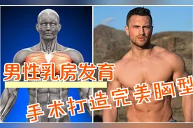 打造完美胸肌，手术也可以？图片