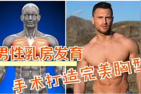 打造完美胸肌，手术也可以？图片