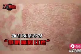 三聚氰胺毒奶粉12年后，再现“大头娃娃”！假特医奶粉事件持续发酵…图片