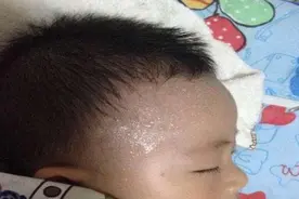 孩子爱出汗是否正常？简单一招轻松解决多汗图片