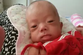 24周的早产宝宝，出生仅980克，如今已变成了意想不到的模样图片