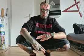 德国男子“变身”成瘾：切掉双耳，支付芯片植手腕，还要割鼻子图片