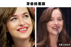 罕见的身体特征：只有少数人身上才拥有的10个罕见的特征图片