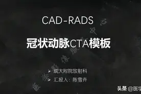 冠状动脉CTA模板图片