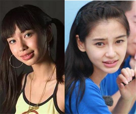 整牙堪比换脸 - 冷求网