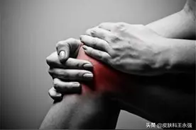 小苏打真的能治痛风吗？得了痛风，这些止痛小妙招很管用图片