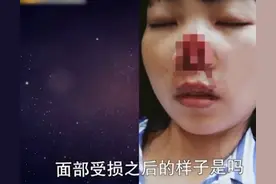 女人心软是病，得治，来自一个被丈夫咬掉鼻子的女人的忠告图片