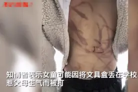 疑因把文具盒遗忘在学校，10岁女孩被爸爸拿衣架鞭打得满身伤痕图片