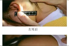 触目惊心！天津“针扎虐童案”一审宣判：3幼教不认罪，法院采信幼儿证言图片