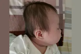 宝宝头型与智商有关系吗？儿科医生提醒：别错过塑造头型关键期图片