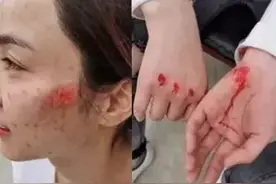 姑娘！你的脸……心疼！图片