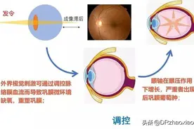 雾视疗法在近视防控中的作用图片