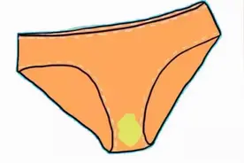 为啥女性内裤上，总有黄色分泌物，这是什么呢？妇科医生说出实情图片
