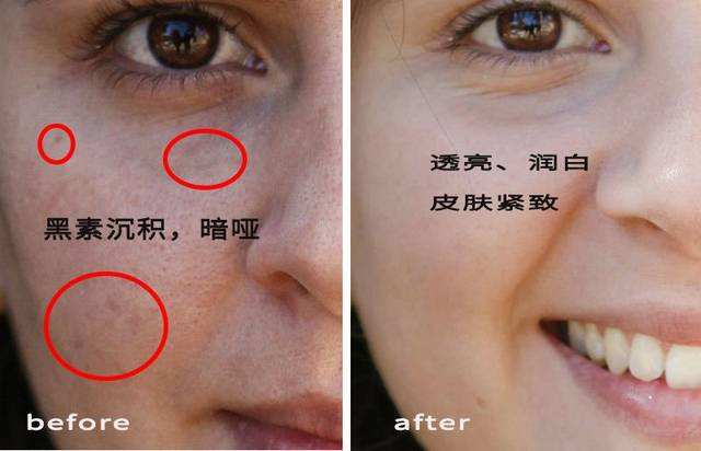 美白身体乳好还是vc粉好