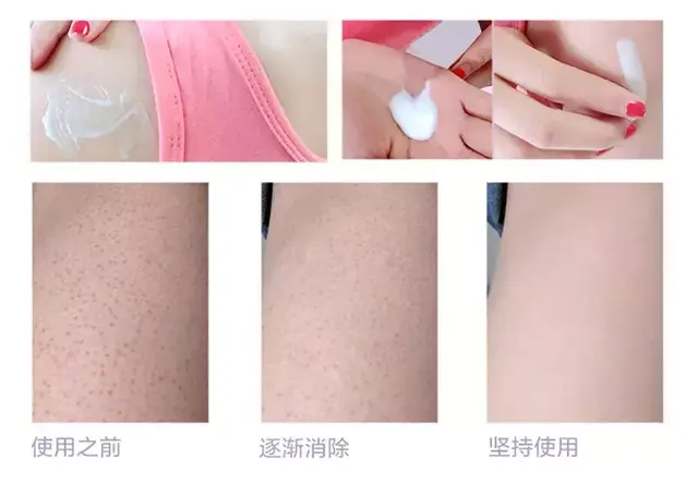 玉泽果酸沐浴露跟果酸身体乳