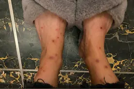 朝阳一小区车库跳蚤泛滥成灾，居民疑心是“它们”惹的祸图片