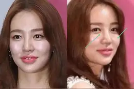 越努力越没眼看，为什么南韩女明星个个精致又肿胀？图片