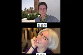 英国男子为变成韩国人8年整容18次：花15万美元 称要做真正的自己图片