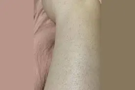 皮肤怎么变光滑图片