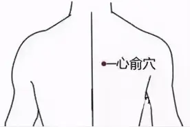心血管科冬病夏治穴位贴敷指南图片