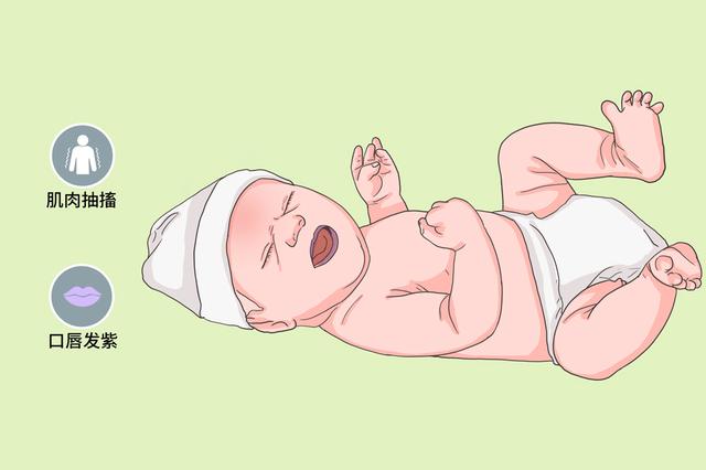 丙酸血症，一种常染色体隐形遗传，造成生化遗传症状，要及时预防