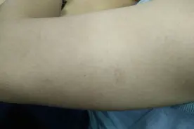 怕打针的福利来了？注射器不用针头，药物0.4秒穿透皮肤，无刺痛图片
