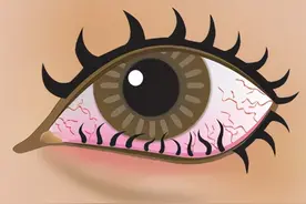 别忽视，宝宝频繁眨眼揉眼未必是困图片