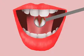 牙齿上抠出来的“小石头”，又黄又臭，到底是什么？如何去掉？图片