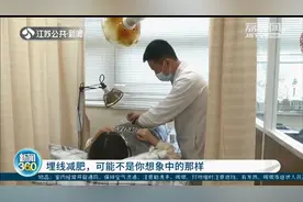 “埋线减肥”或非你想象中的那样！效果因人而异，并非人人都适合图片